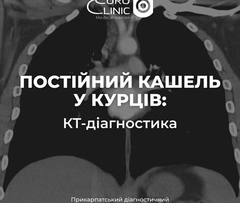 Тривалий кашель у курців — сигнал пройти КТ