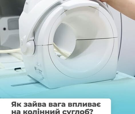 Як зайва вага впливає на колінний суглоб?