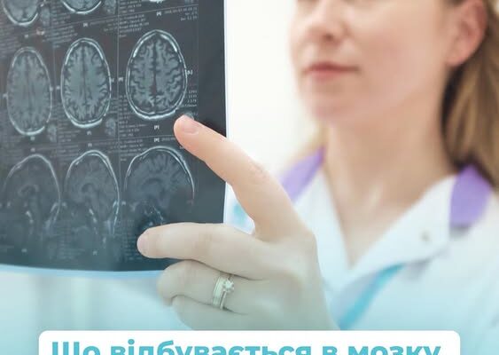 МРТ-дослідження: що відбувається в мозку, коли людина бреше?