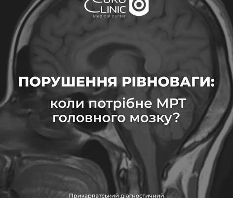 Порушення рівноваги: коли потрібне МРТ головного мозку?