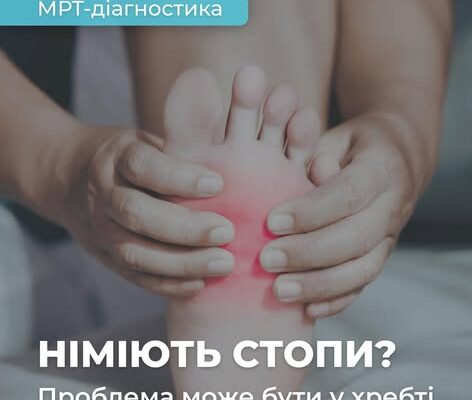 Німіють стопи? Причина може ховатися у хребті